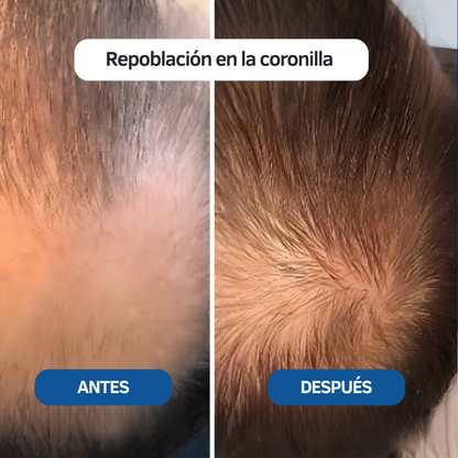 Peptidyn® Micro-infusión de Peptidos