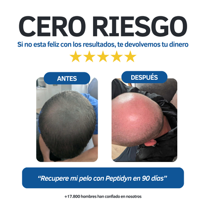 Peptidyn® Micro-infusión de Peptidos
